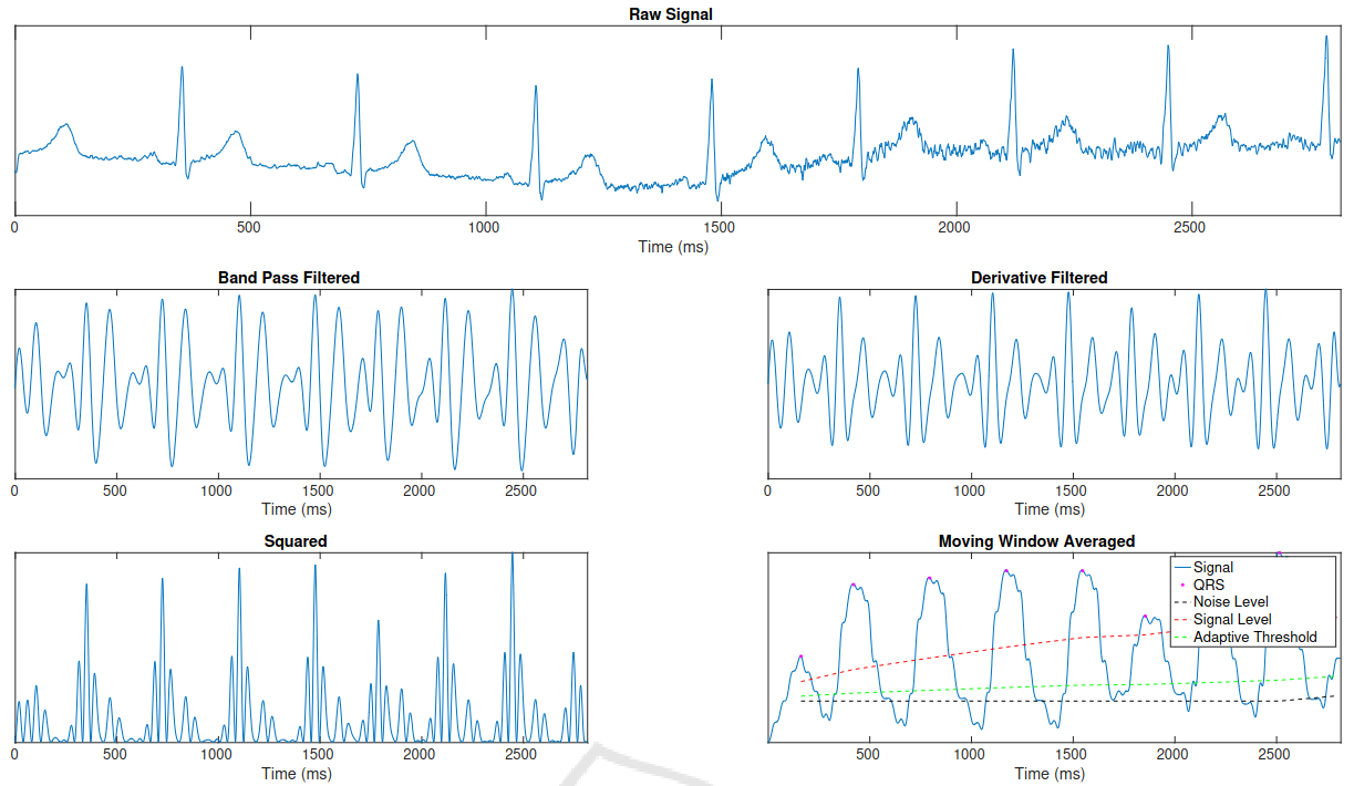 Pan Tompkins Algorithm Output
